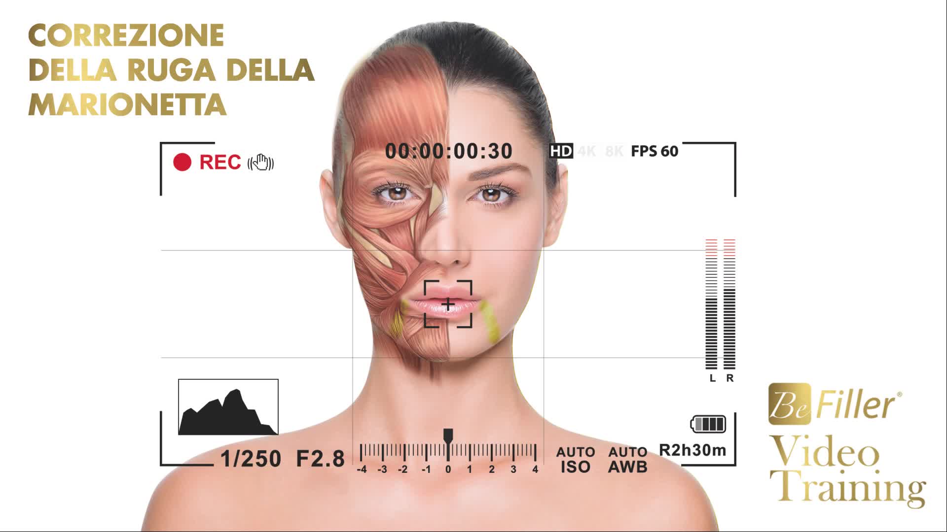 Correzione della ruga della marionetta - Befiller Videoclass